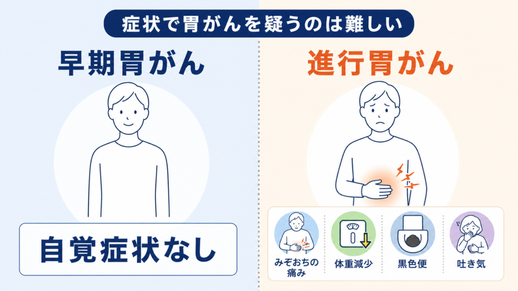早期胃がんと進行胃がんの症状の有無を対比した図解。早期はほぼ無症状である一方、進行するとみぞおちの痛みや体重減少などの症状が出ることを示している。