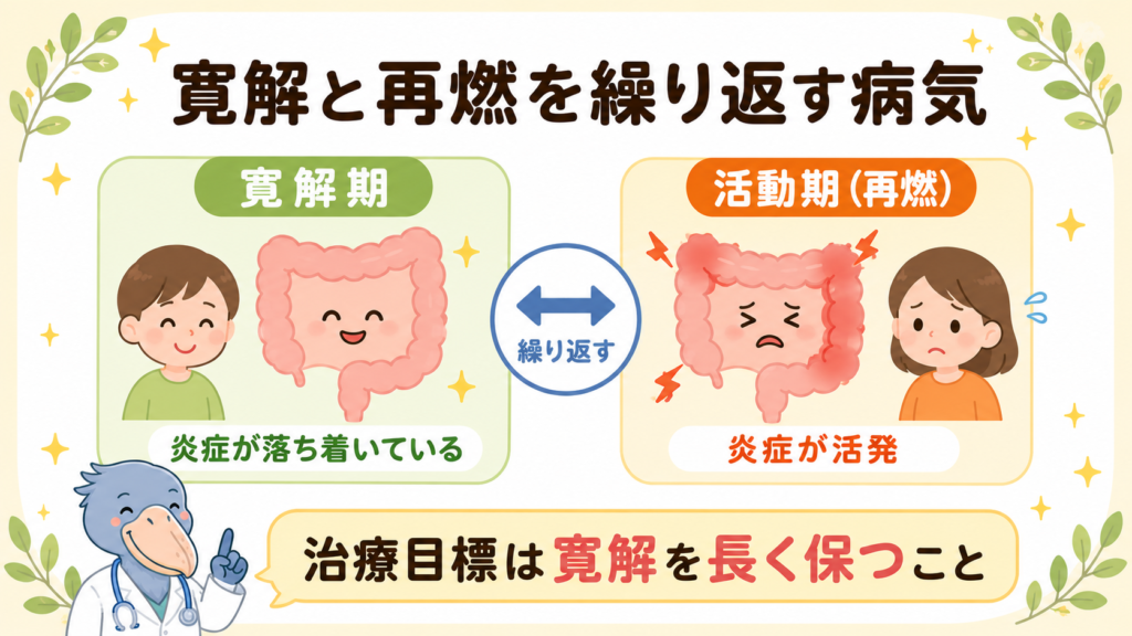 潰瘍性大腸炎の寛解期と活動期（再燃）を左右で対比した解説図