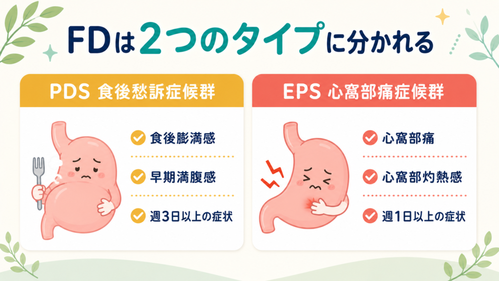 機能性ディスペプシアの2タイプ(食後愁訴症候群PDSと心窩部痛症候群EPS)の違いを示す図