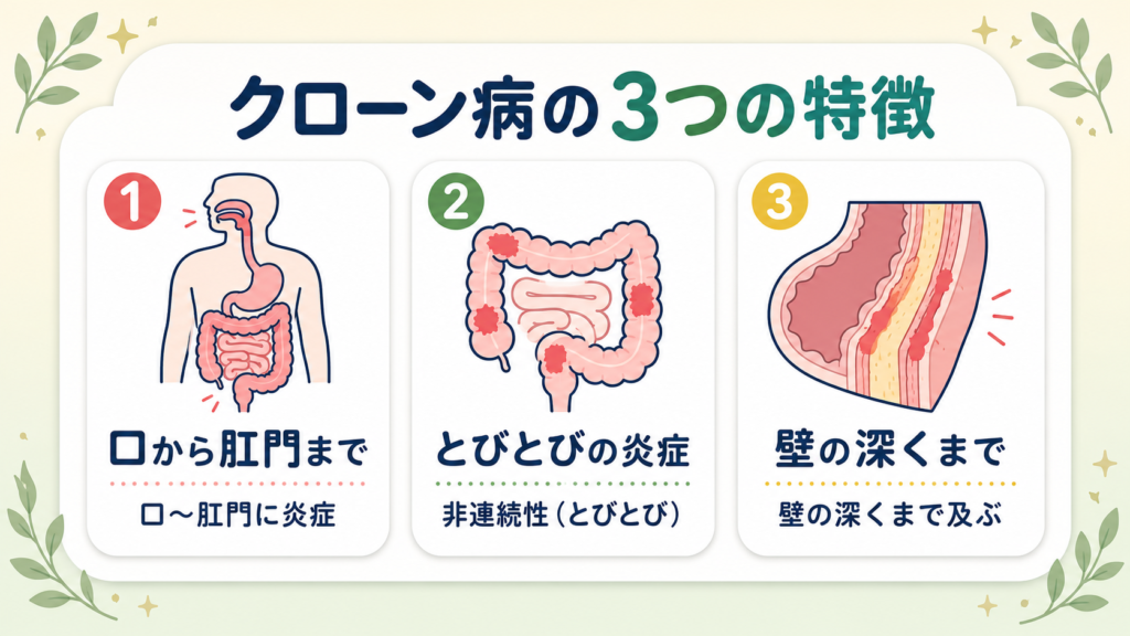 クローン病の3つの特徴を示す図。口から肛門まで・とびとびの炎症・腸壁の深くまで及ぶことを表す。